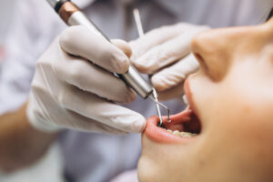 Extracciones dentales